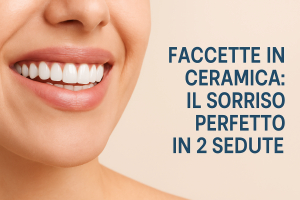 Faccette Dentali