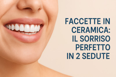 Faccette Dentali