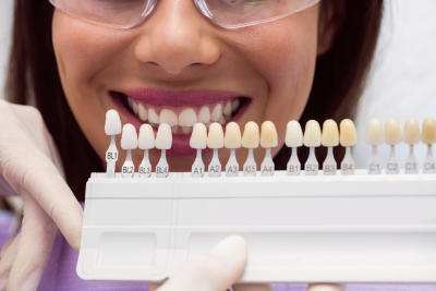 Faccette dentali rendere il sorriso pi&ugrave; luminoso Roma zona Mezzocammino Spinaceto