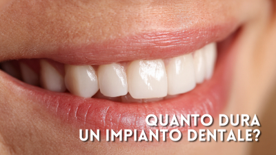 L&rsquo;impianto dentale dopo anni: come capire se &egrave; tutto ok (e quando fare un controllo)
