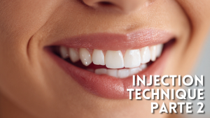 Injection Technique odontoiatrica: i segreti della tecnica passo dopo passo