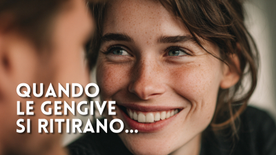 Quando le gengive si ritirano: cause, sintomi e soluzioni per tornare a sorridere senza dolore